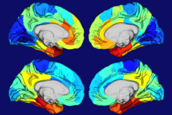 Can a Drug Prevent Alzheimer’s Disease Decades Before It Happens?