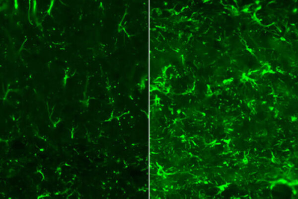 New strategy reduces brain damage in Alzheimer’s and related disorders, in mice